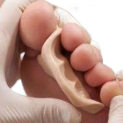 Ortoplastia